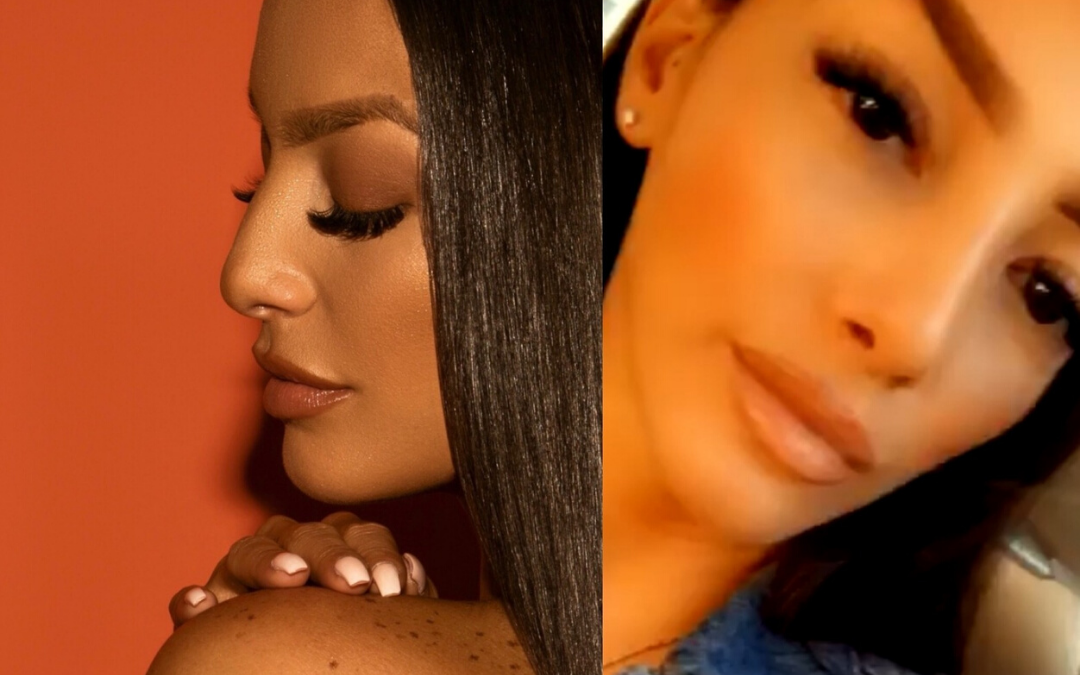 Female Ethnic Rhinoplasty