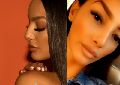 Female Ethnic Rhinoplasty